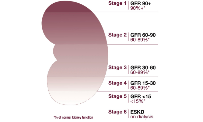 CKD Stages